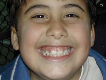 Ziggurat smile!